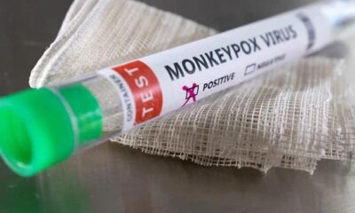 New monkeypox case detected in Pakistan