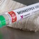New monkeypox case detected in Pakistan
