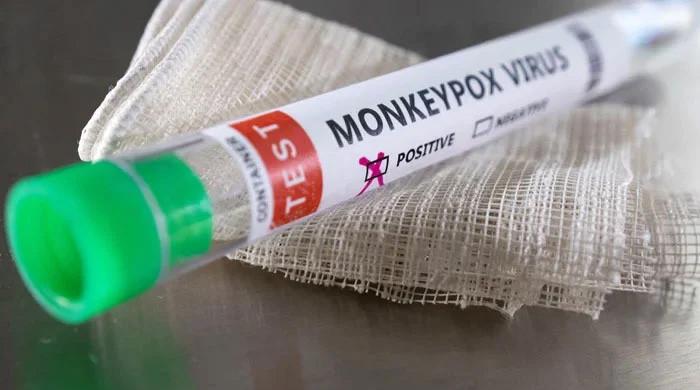 New monkeypox case detected in Pakistan