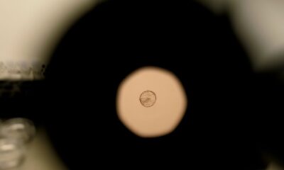 Scientists Just Caught Human Embryo Implantation on Camera