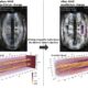First experimental proof of multiscale coupling in plasma has implications for fusion energy