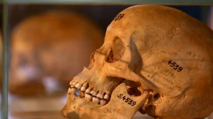 Madagascar receives skull of beheaded king returned by France Madagascar receives skull of beheaded king returned by France
