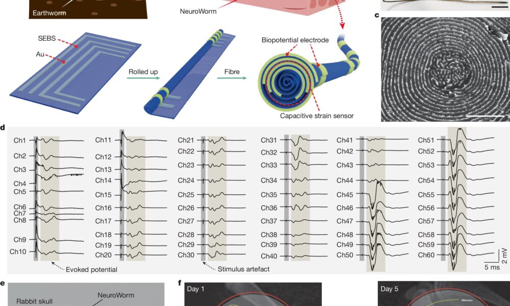 Soft ‘NeuroWorm’ electrode allows wireless repositioning and stable neural monitoring