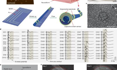 Soft ‘NeuroWorm’ electrode allows wireless repositioning and stable neural monitoring