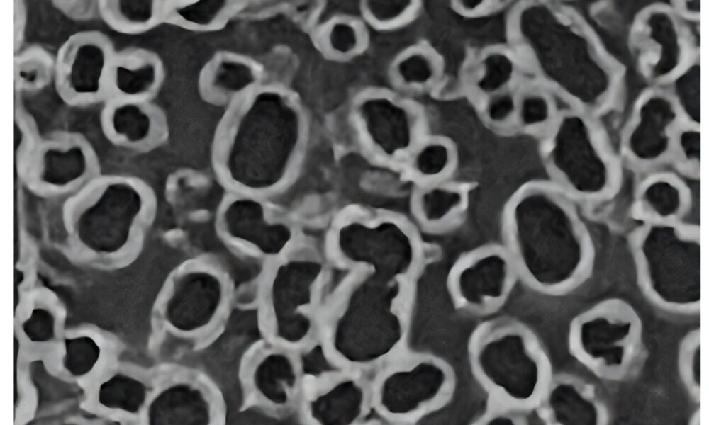 High-performance supercapacitor made from upcycled water bottles