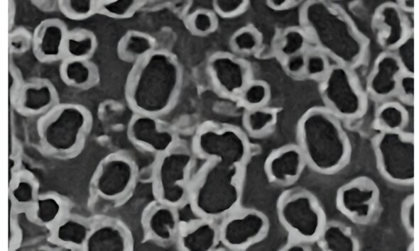 High-performance supercapacitor made from upcycled water bottles