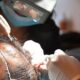 Dubai police arrest man running illegal hair transplant clinic