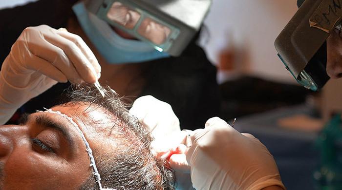 Dubai police arrest man running illegal hair transplant clinic