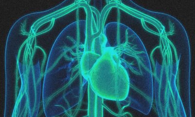 A Gene Editing Therapy Cut Cholesterol Levels by Half