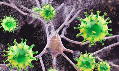 Measles Is Causing Brain Swelling in Children in South Carolina