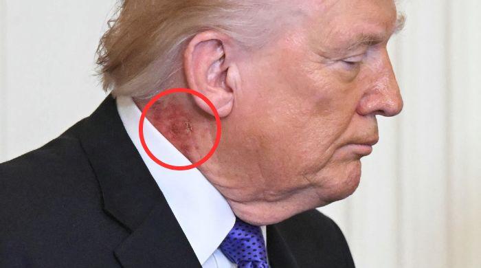 Trump’s neck rash sparks fresh health questions