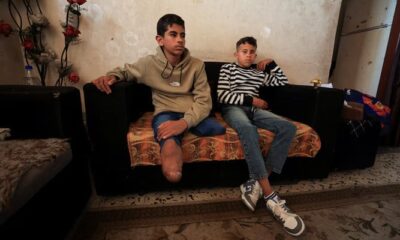 Gaza’s war amputees short of prostheses under Israeli restrictions