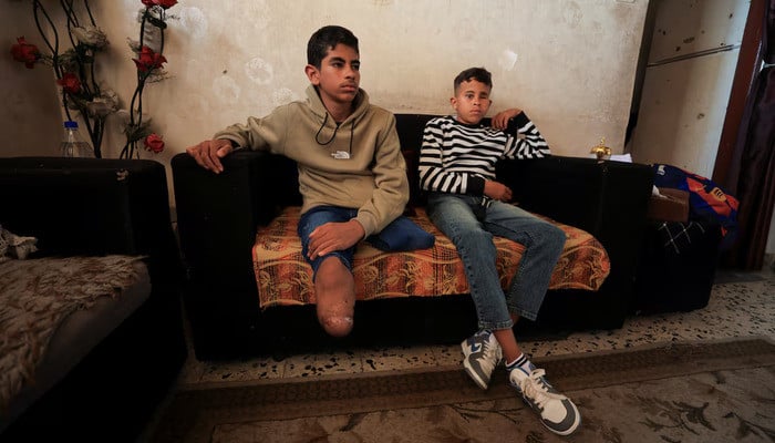 Gaza’s war amputees short of prostheses under Israeli restrictions