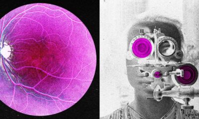 Longevity Startup Doses First Human in Bid to Reverse Age-Related Sight Loss