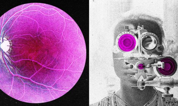 Longevity Startup Doses First Human in Bid to Reverse Age-Related Sight Loss